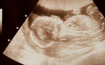 湖北省试管婴儿医院大全（能做第三代试管的只有4家）