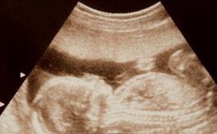 做试管婴儿补充哪些微量元素提高成功率