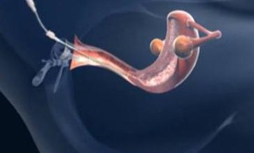 福州最新试管婴儿医院汇总，附怀孕技术好的主任医生推荐