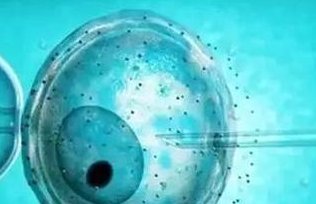 多囊去马来西亚阿尔法医院做试管怎么样？附试管费用明细